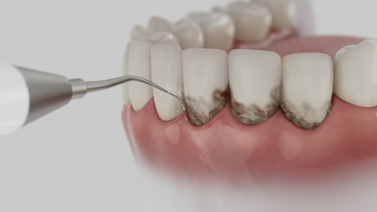 Trusted Teeth Cleaning And Checkup service in Gray, TN - Dentist Open Now
